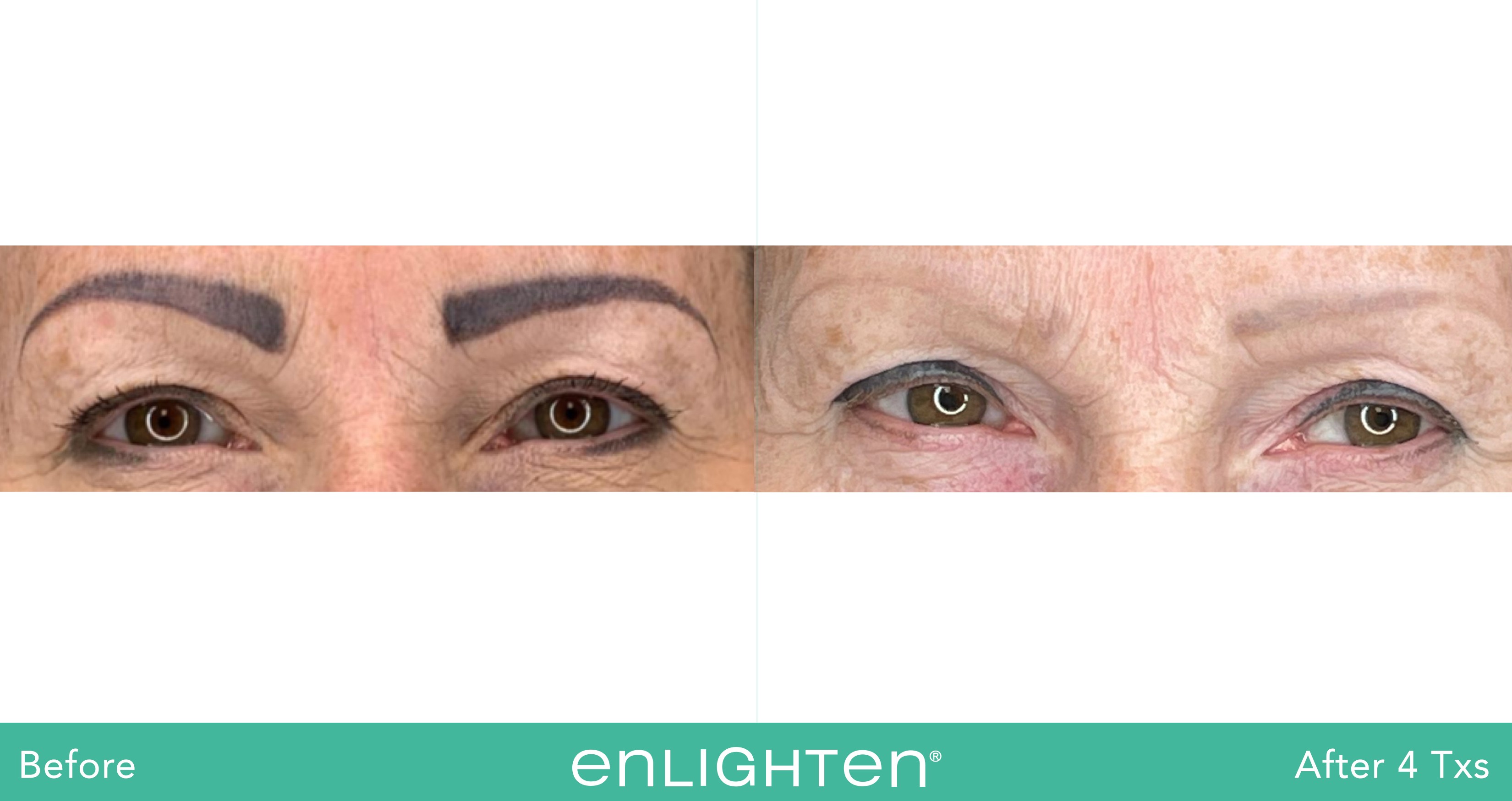 03 enlighten BA Lustre