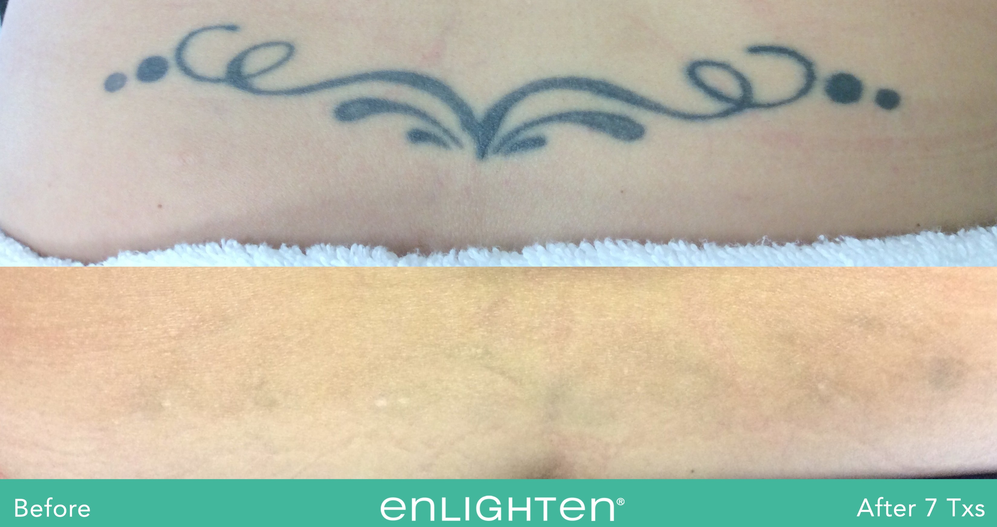 enlighten M Aggarwal BA Tattoo