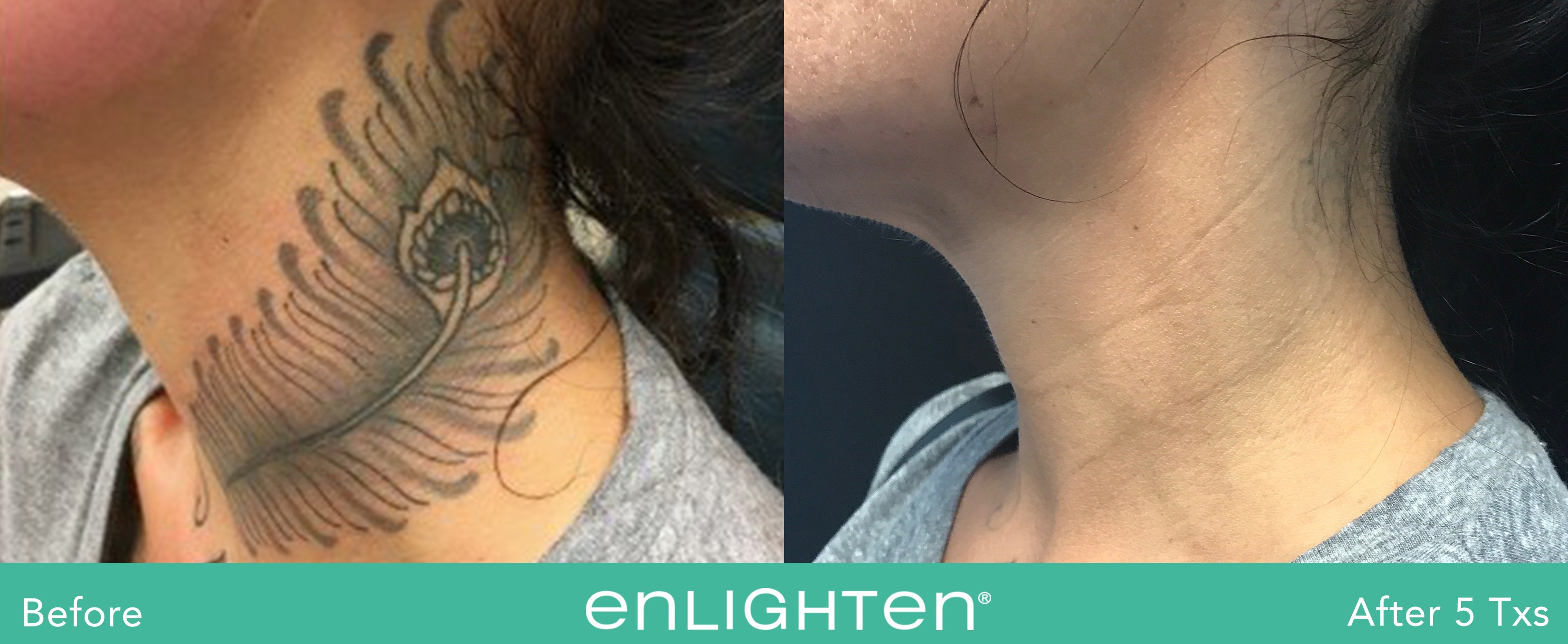 enlighten B A Erasable A