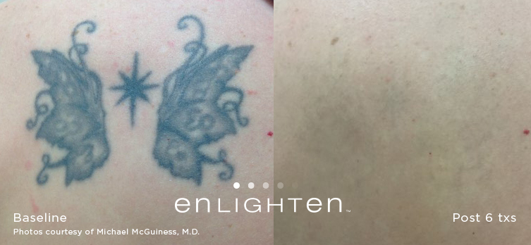 enlighten Tattoo Butterfly 2 1