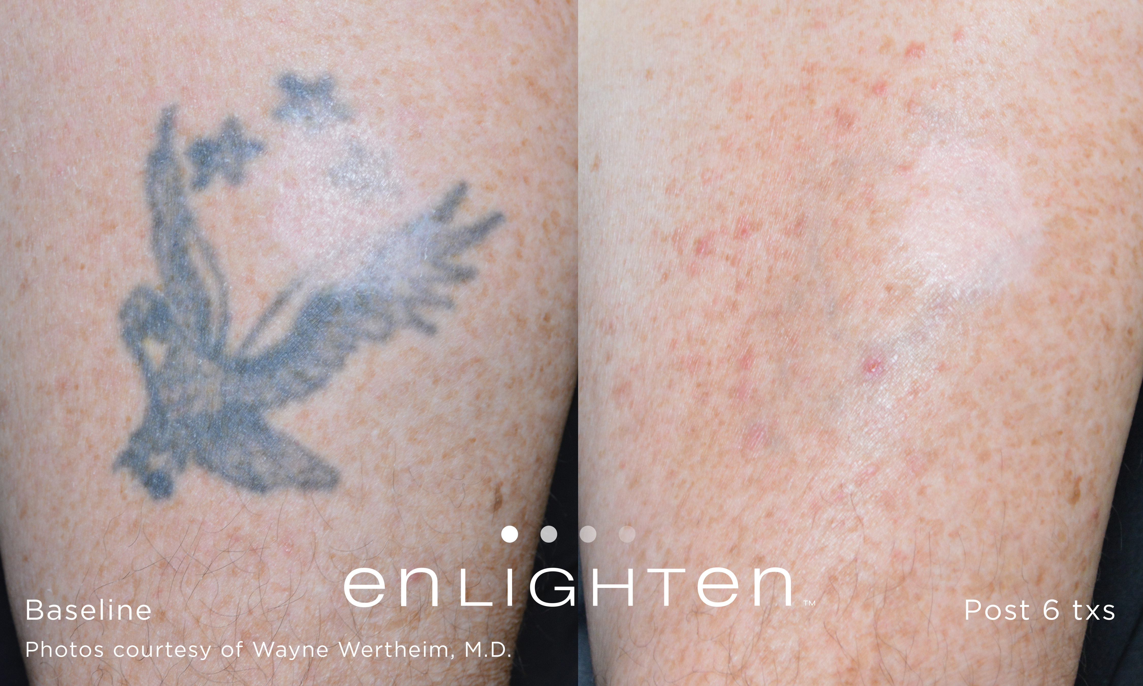 enlighten Tattoo Eagle