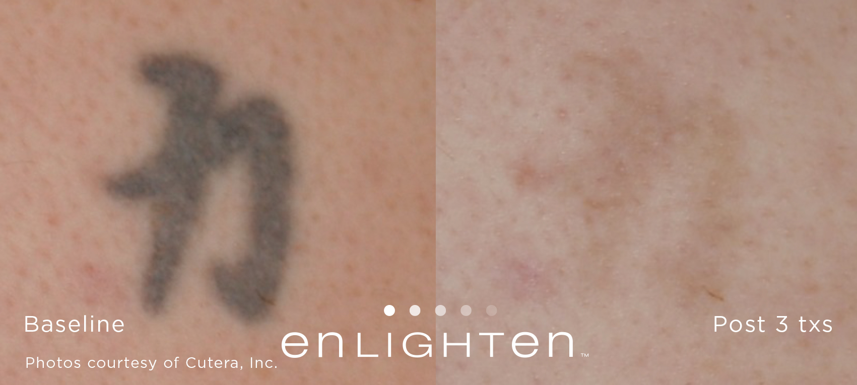 enlighten Tattoo Kanji